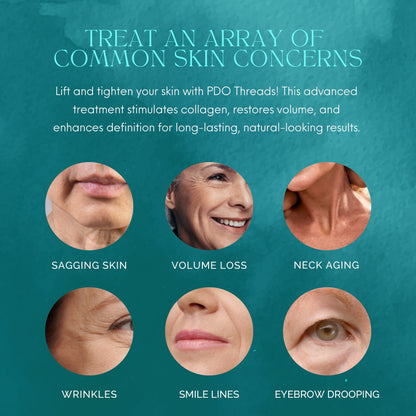 PDO Threads Mid &amp; Lower Face Lift | Tighten, Tone with a Mini-Face Lift in 90 Minutes. No Fillers, No Surgery, Just an Instant Lift.