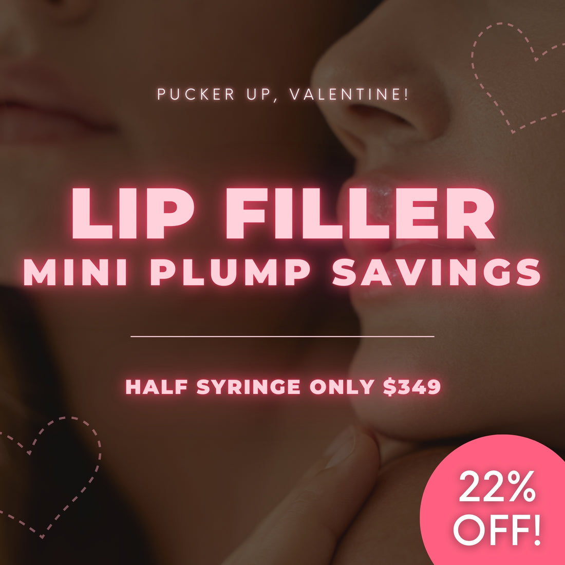 Mini Lip Plump | Half Syringe Lip Filler