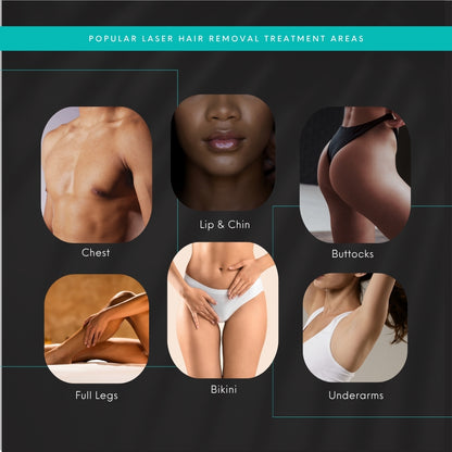 Laser Hair Removal | Buy 1 Area Package, Get 2nd Area Package FREE